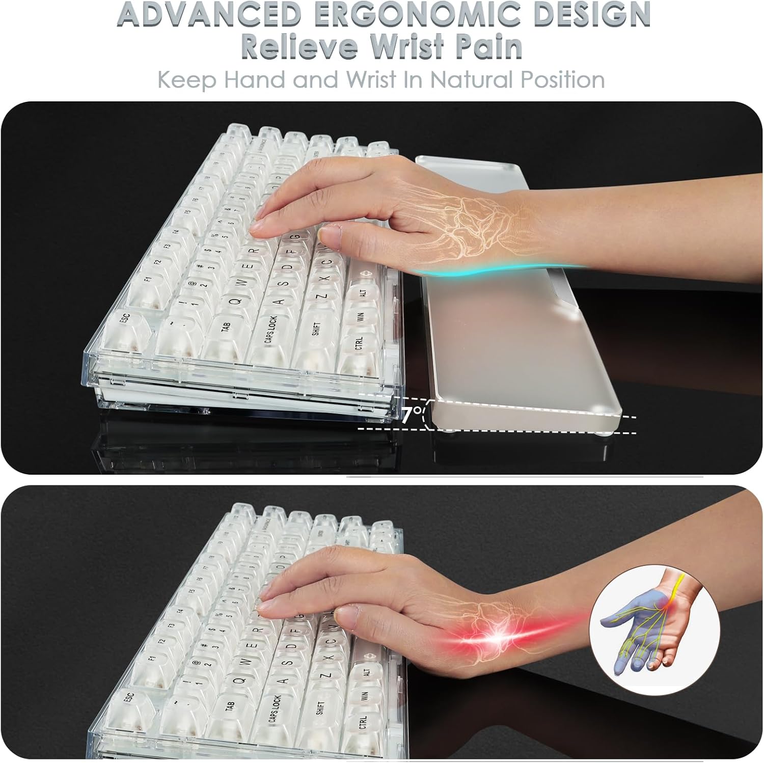 Acrylic Gaming Keyboard Wrist Rest,Clear Ergonomic Palm Rest with Anti-Slip Base,Customized Metal CNC Aluminum Alloy Logo for Compact 60% Computer Keyboard,Office,Home,Laptop,Mac,Easy Typing-Black 43 71BfRY4aKaL. AC SL1500 - northernschoolofshiatsu.co.uk